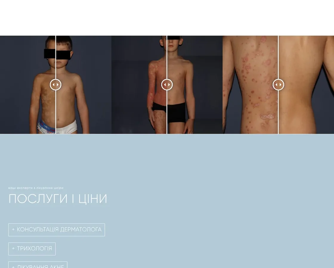 Skin Treat — центр лікування хронічних захворювань шкіри у Львові — скріншот сайту